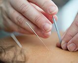 acupuncture via UnSplash: Katherine Hanlon tinymountain