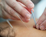 acupuncture via UnSplash: Katherine Hanlon tinymountain